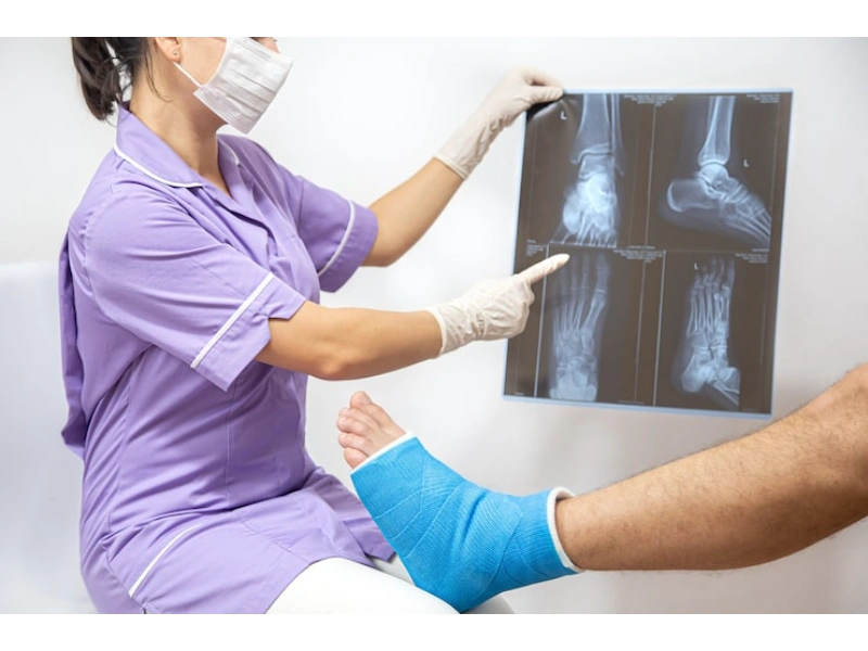Fracture Treatment in Indore