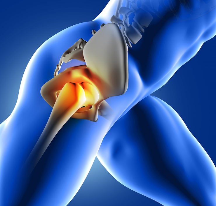 hip replacement surgery in indore