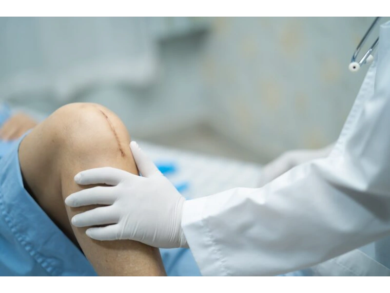 Knee Arthroscopy Surgery in Indore