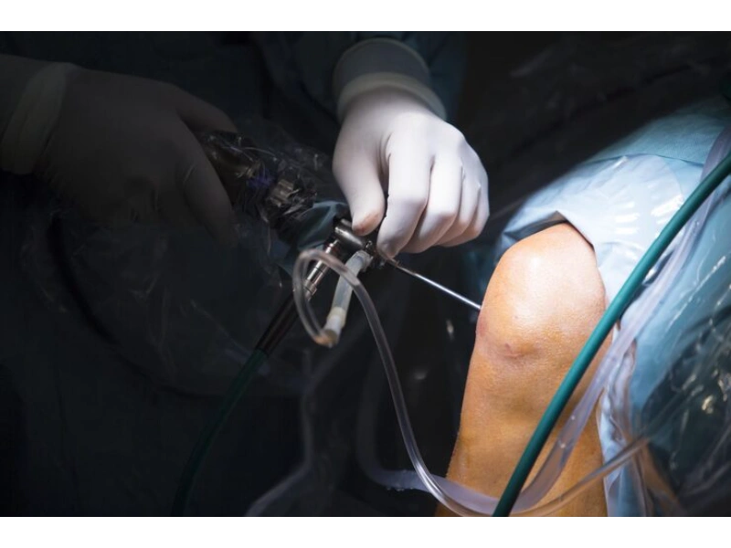 Meniscus Surgery in Indore