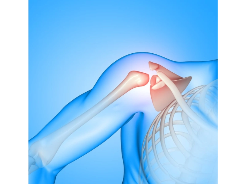 Shoulder Arthroscopy Surgery in Indore