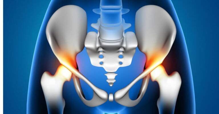 hip Replacement in indore