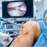 Knee Arthroscopy Surgery in Indore